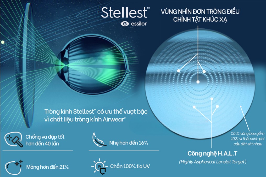 Ưu điểm vượt trội của tròng kính Stellest