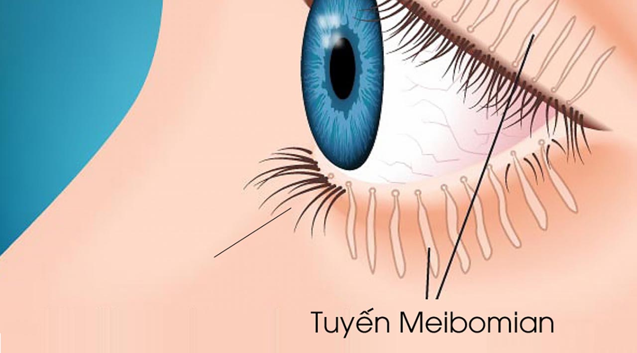 Vai trò và tác động của tuyến Meibomian