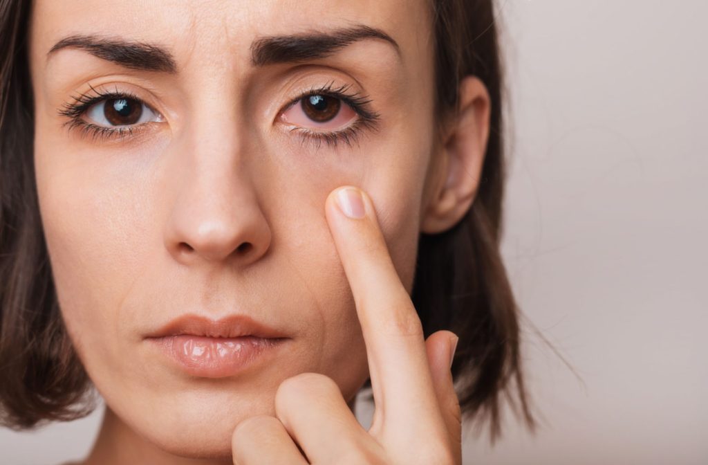 Tổng quan về vai trò và tác động của tuyến Meibomian đối với sức khỏe mắt